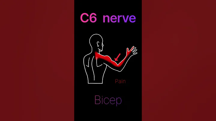 pinched nerve in the neck? #shorts