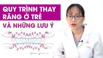 Quy trình thay răng ở trẻ và lưu ý