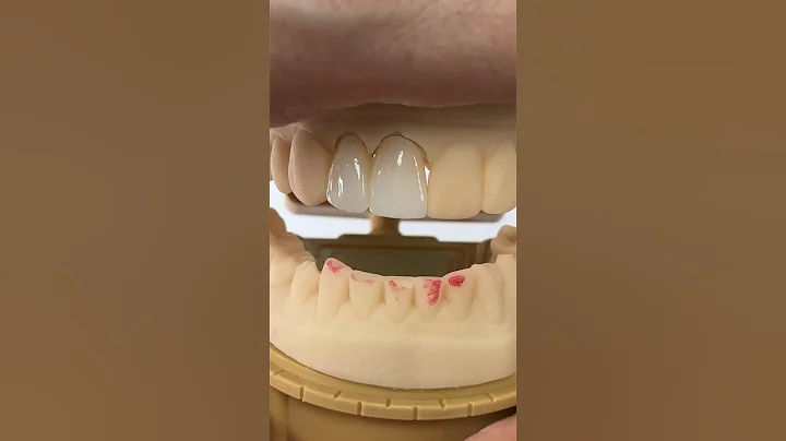 Great Esthetics @EnvisiontecMain #envisiontec #dentist #teeth #smile #lsk121shorts #shortvideo