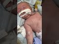 My Son battling stage 4 cancer and trying to reach my surgery goal.🙏help me reach someone who cares😭