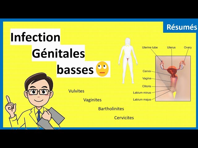 Les infections génitales basses 👩 ⁉🤔  - Résumé - Gynéco_obstétrique
