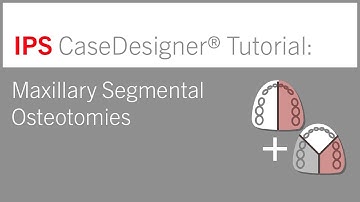 Maxillary Segmental Osteotomies | IPS CaseDesigner® Tutorial
