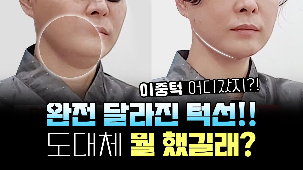 두툼~한 이중턱 싹- 없애고 V라인 만드는 방법!! - YouTube