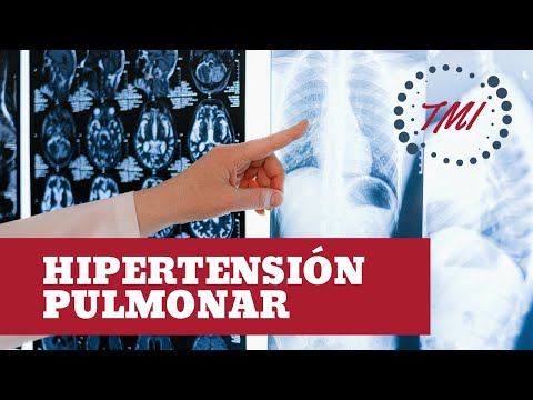 Hipertensión Pulmonar