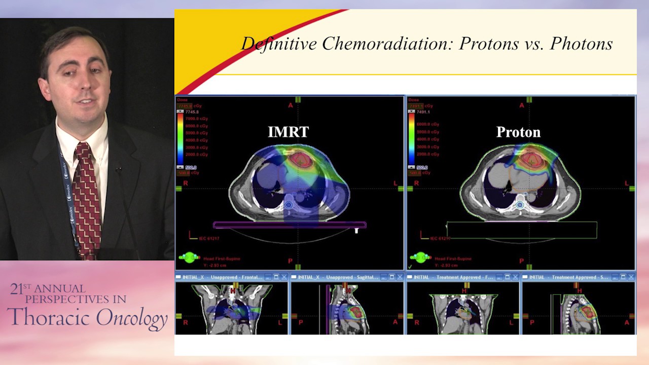 prostate sbrt prostate sbrt