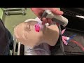 Dealing with massive airway contamination during intubation