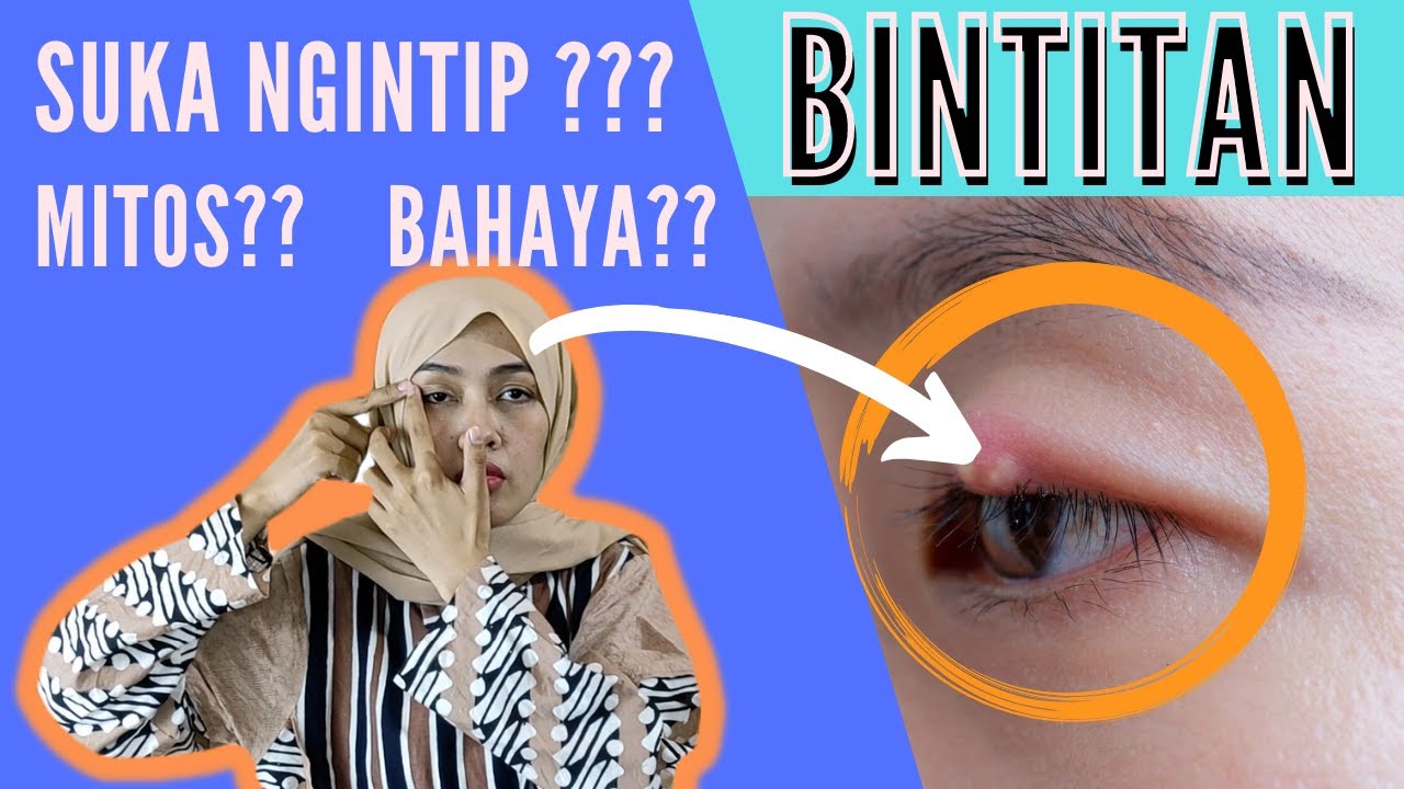 ANEH KENAPA BISA MUNCUL BINTITAN/TIMBILAN Gejala, Penyebab dan Cara