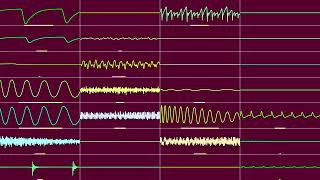 Oxygener - Hammasharja (Oscilloscope View)
