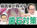 歯石がつきやすい人必見!歯周病などを引き起こす歯石をつきにくくする対策を現役の歯医者がご説明します