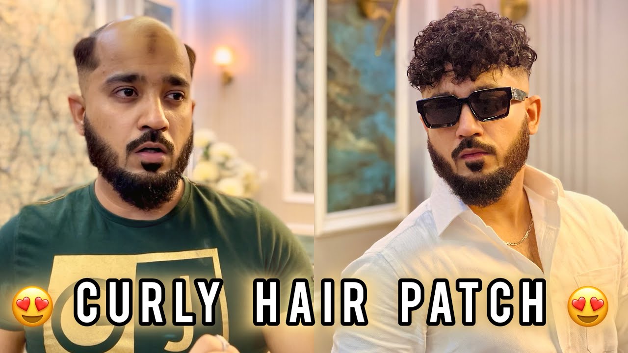 Permanent Hair Patch Delhi | Curly Hair Patch Mens | Call Us : 9650914665