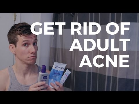 Best Men's Skin Care Routine for 2017 (Tiege Hanley + Differin Gel)