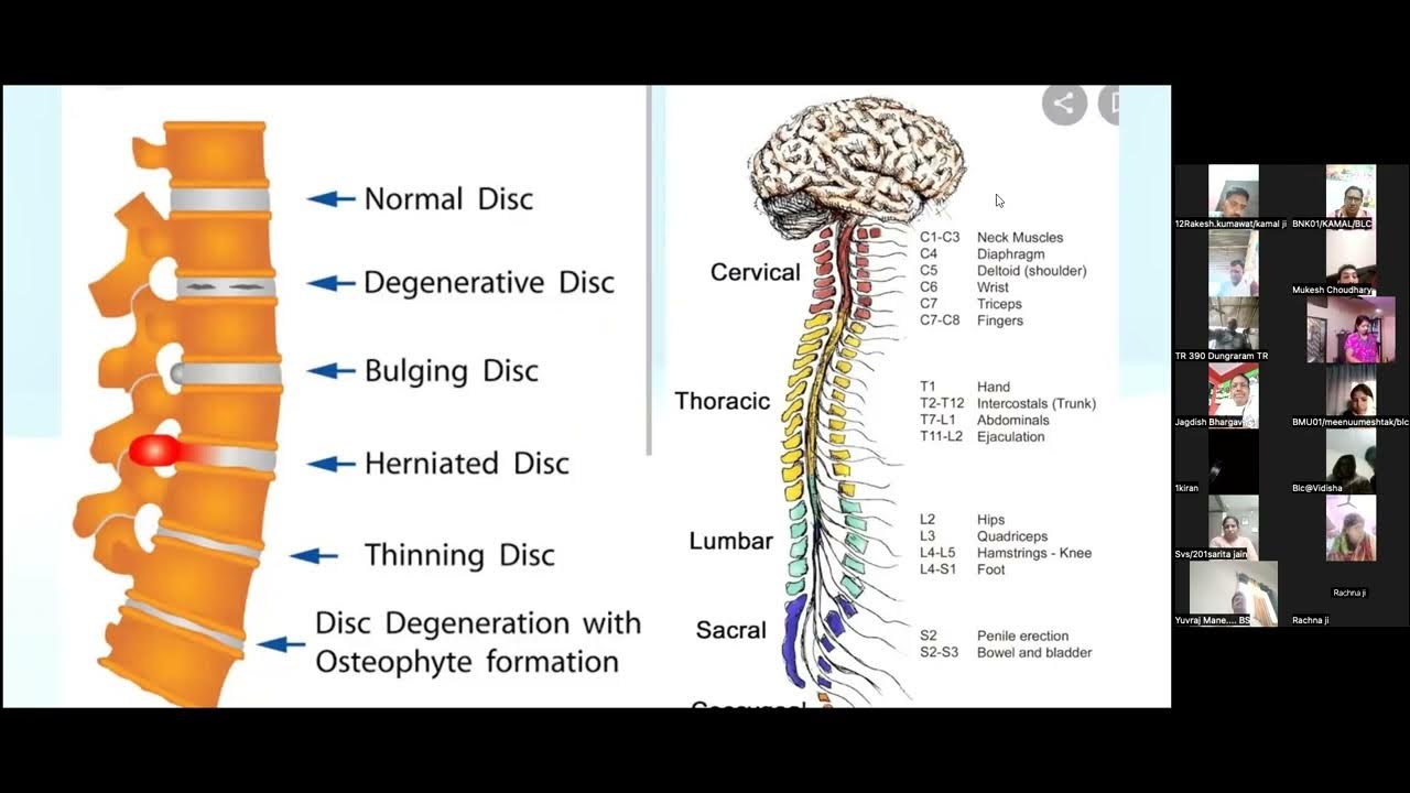 slip disc problem and Management YouTube