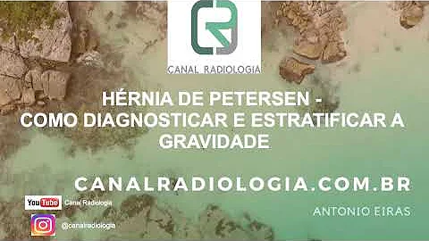 Quais os sintomas da hérnia de Petersen?