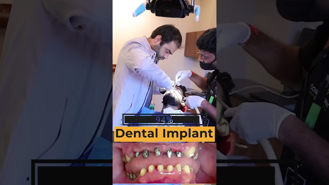 Smile Transformation: Dental Implant at Cosmodent India