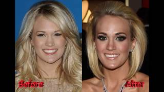 Did Carrie Underwood Really Get Plastic Surgery