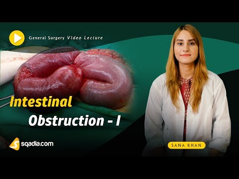 आंतों में रुकावट | सामान्य सर्जरी | ऑनलाइन चिकित्सा शिक्षा वीडियो | वी-लर्निंग™