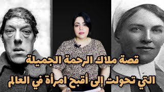 أقبح إمرأة في العالم.. ملاك الرحمة ماري آن بيڤان