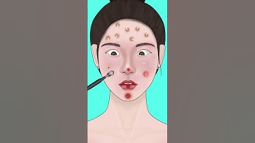 ASMR Treatment for Pimples #asmr #animation #satisfying #trending #viral #shorts #trendingshorts