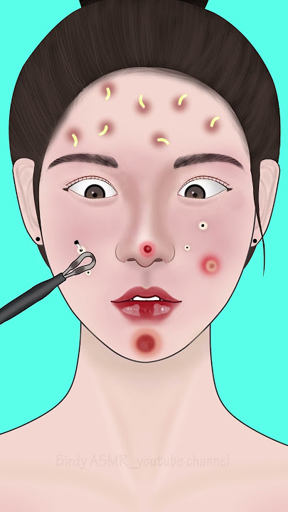 ASMR Treatment for Pimples #asmr #animation #satisfying #trending #viral #shorts #trendingshorts