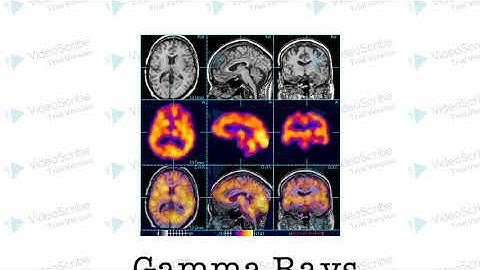 Benefits and Impacts of Radioactive Tracers