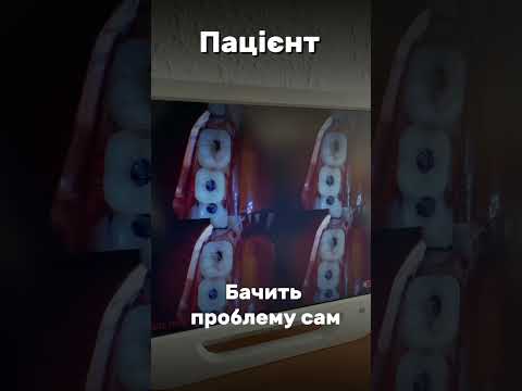 Інтраоральна камера з монітором 17 + кронштейн, видео 1