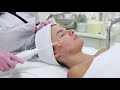 Saian Acne treatment using natural products and a high frequency machine