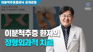 이분척추증 환자의 정형외과적 치료