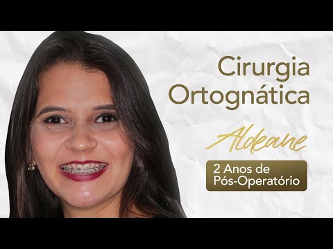 Aldeane, dois anos de pós-operatório