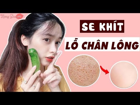 Cách Làm Se Khít Lỗ Chân Lông To Ở Mặt Chỉ Bằng 1 Quả Dưa Chuột