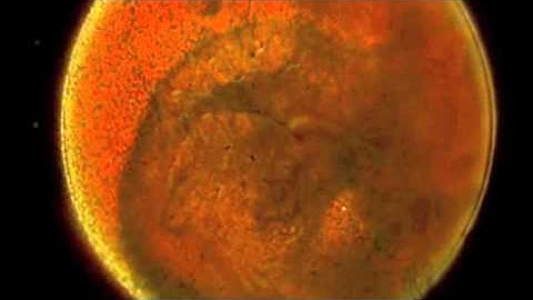 SICKER MAN  - takawe te