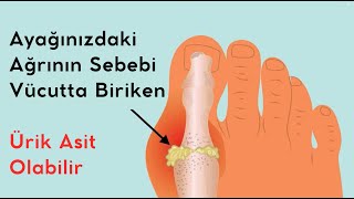 Ayağınızdaki Ağrının Sebebi Vücutta Biriken Ürik Asit Olabilir