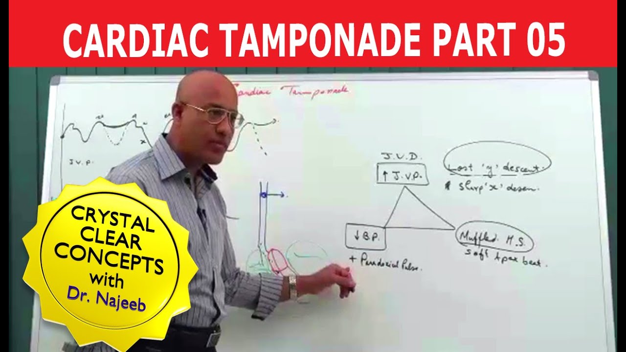 Cardiac Tamponade | Cardiology | Part 5/5