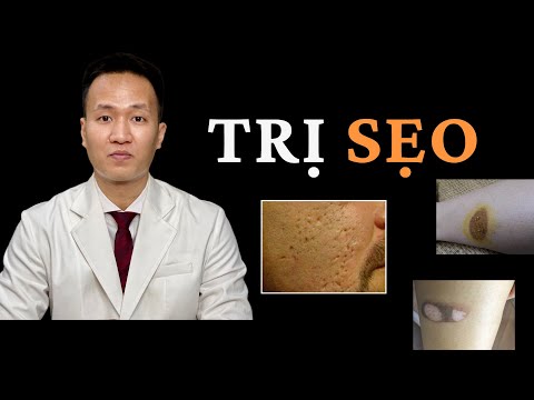 Contractubex có thật sự trị được Sẹo | Cách xử trí sẹo ĐƠN GIẢN hiệu quả - Dr Hiếu