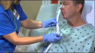 Dobhoff or NG Tube Management