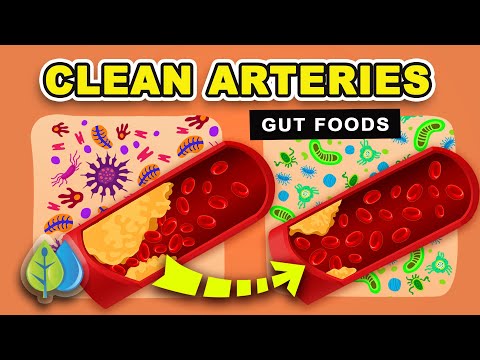 5 Gut Foods to Clean Out Your Arteries