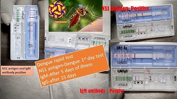Dengue NS1 antigen positive IgM positive and IgG positive and significances in dengue fever