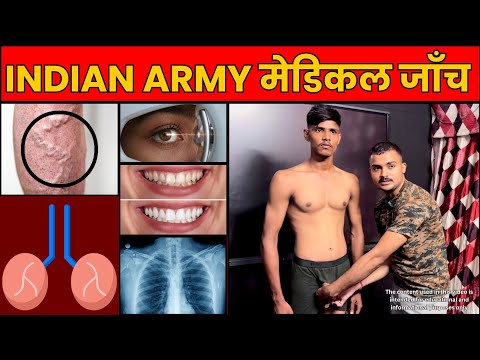 Girls Please Stay Away From This Video Army Agniveer Medical Checkup Indian Army Medical Che