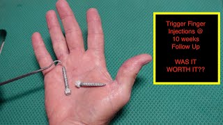 Trigger Finger Injections 10 Weeks Follow Up...DID IT WORK?