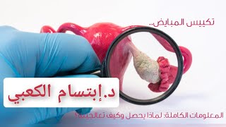 تكيسات المبايض|اسبابه وعلاجه للمتزوجة والعزباء|حدوث الحمل مع تكيسات المبايض|د.إبتسام الكعبي