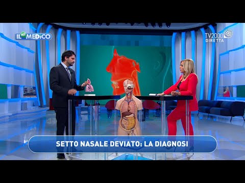 Video: Ho deviato il mio setto?