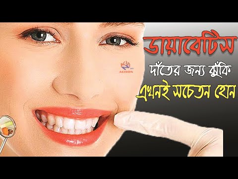 dental problems in diabetes patient bangla ।।দাঁতের সমস্যায় ডায়াবেটিস রোগীদের ঝুঁকি,বাঁচার উপায়।