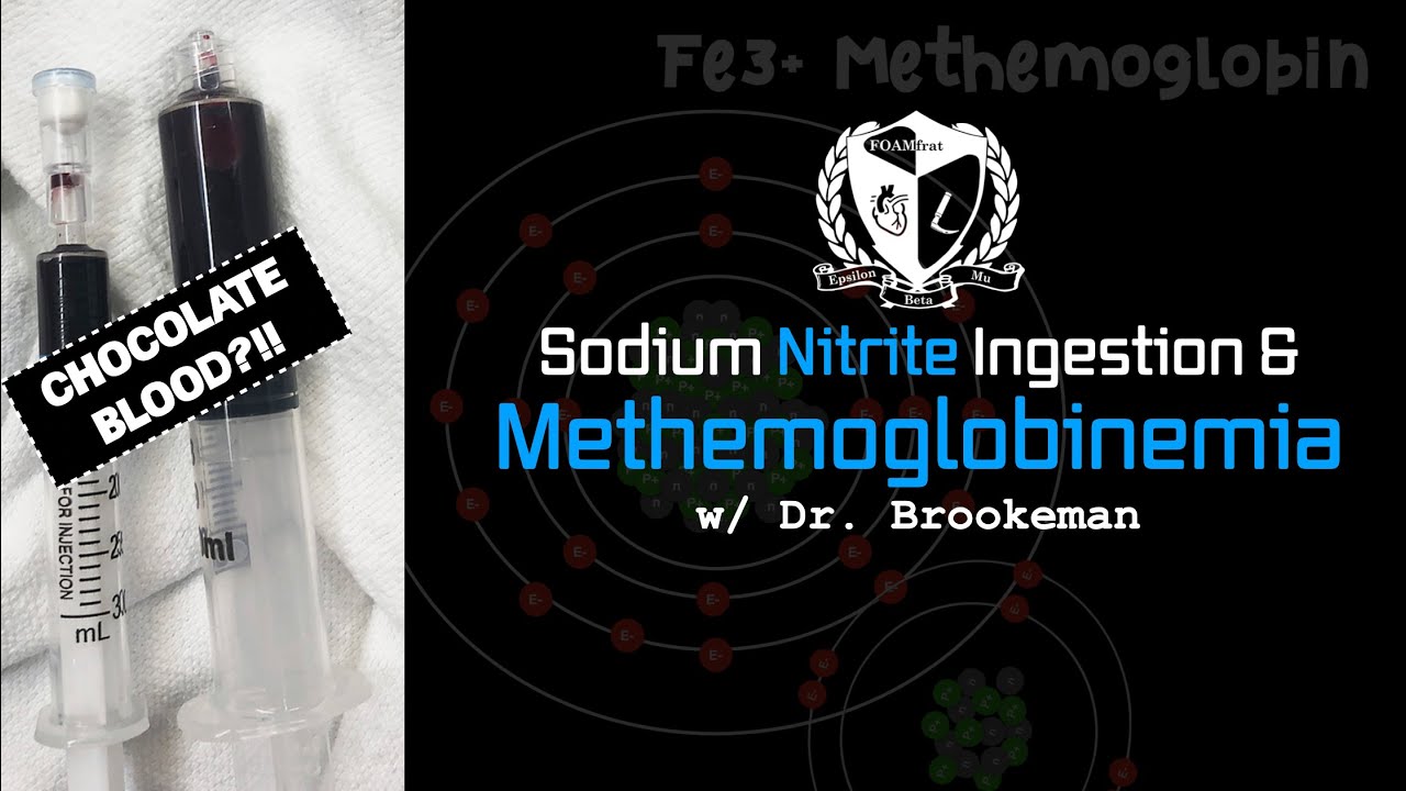 Sodium Nitrite Ingestion & Methemoglobinemia w/ Dr. Brookeman
