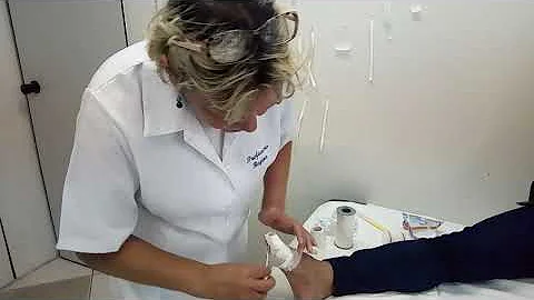 Como tratar alergia a esparadrapo?