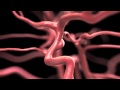 Aneurysm: Signs Symptoms Risks and Treatments Explained By Memorial Neuroscience Institute