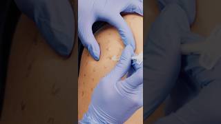 Living With Central Texas Allergies? Don’t Ignore Nasal Blockage #allergies #allergist