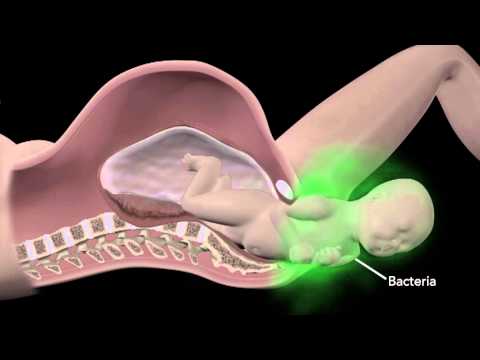 Vídeo: Infecció Bacteriana (estreptococ) En Gossos