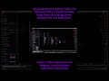 TholviProfile Launch | Market Profile, Volume Profile, Delta &amp; Composite Profiles