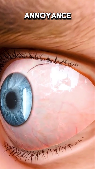 what-happens-after-lash-serum-i-m-here-to-tell-you-before-after