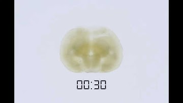 See through a mouse brain slice cleared by the X-CLARITY™
