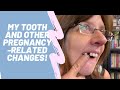 How I Lost MY TOOTH and other pregnancy-related tales!